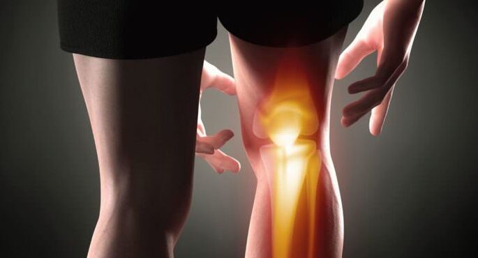 Joint symptoms