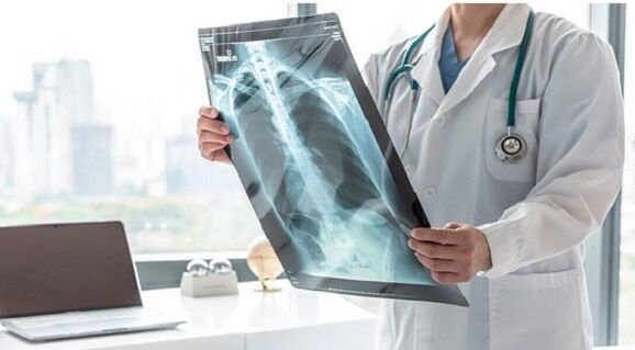 X-ray diagnosis of pain below left shoulder blade