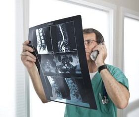 Myelography to diagnose osteochondrosis and intervertebral hernia
