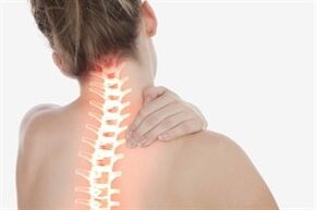 Female cervical osteochondrosis